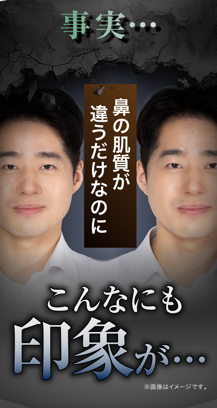 事実…鼻の肌質が違うだけなのにこんなにも印象が変わる
