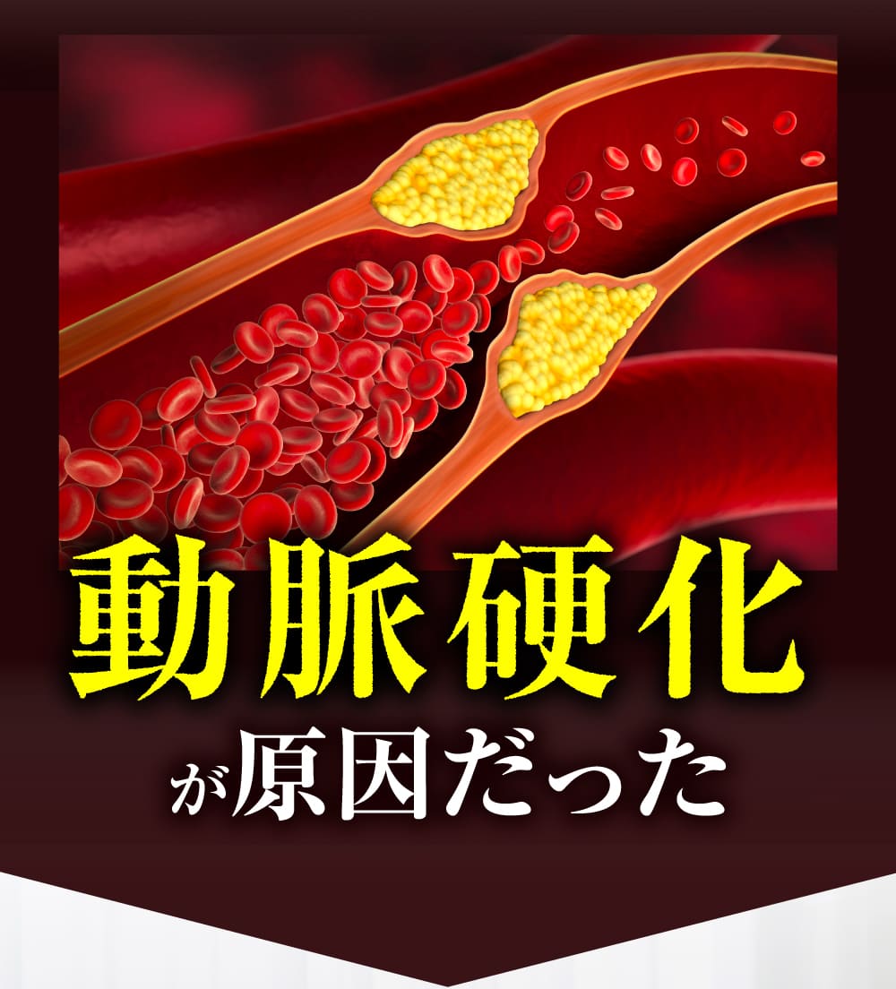 つまり、動脈硬化が原因だった。