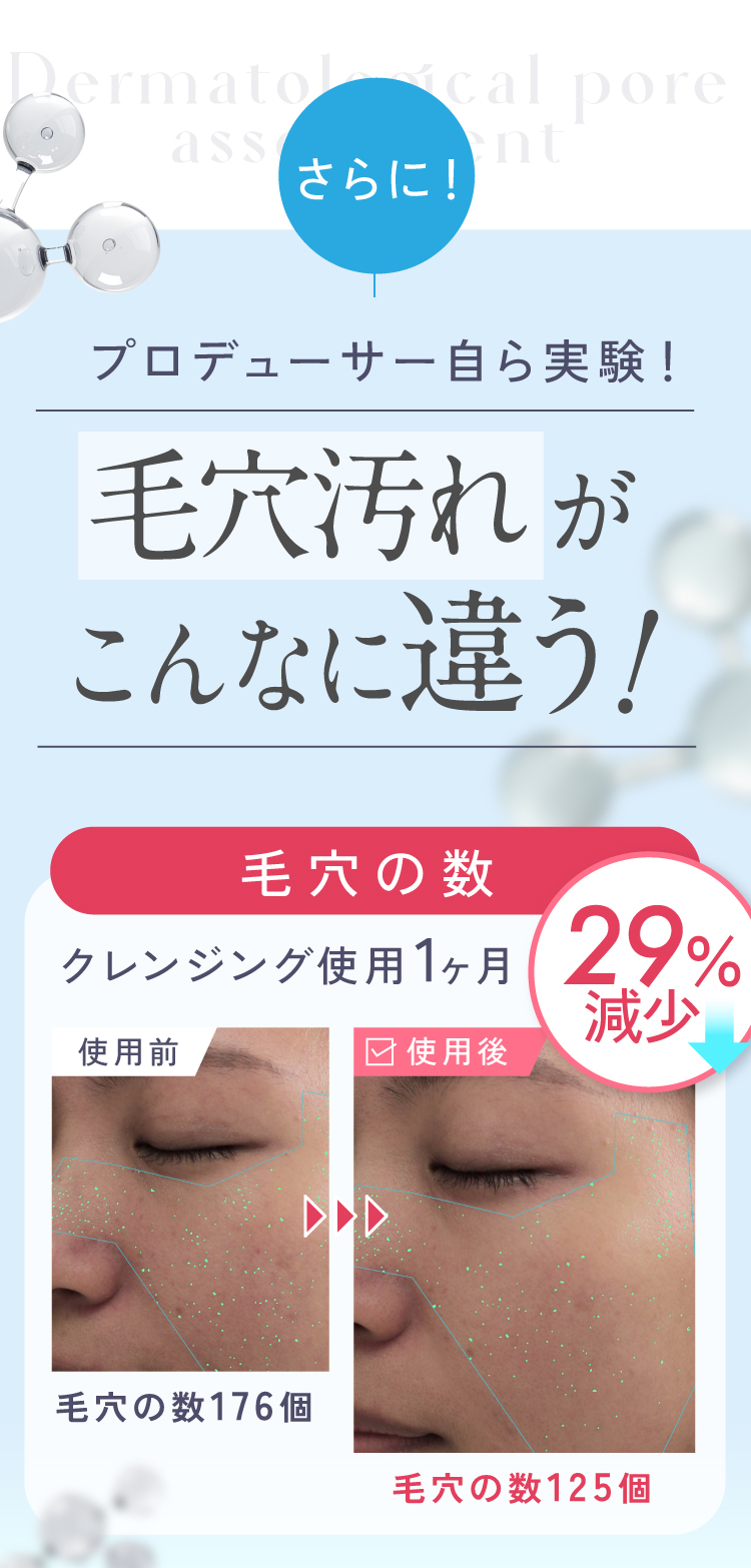 毛穴汚れが29%も減少！