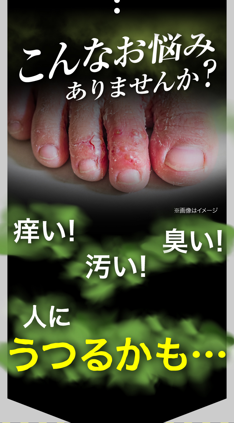 こんなお悩みありませんか？ 痒い・汚い・臭い・人にうつるかも