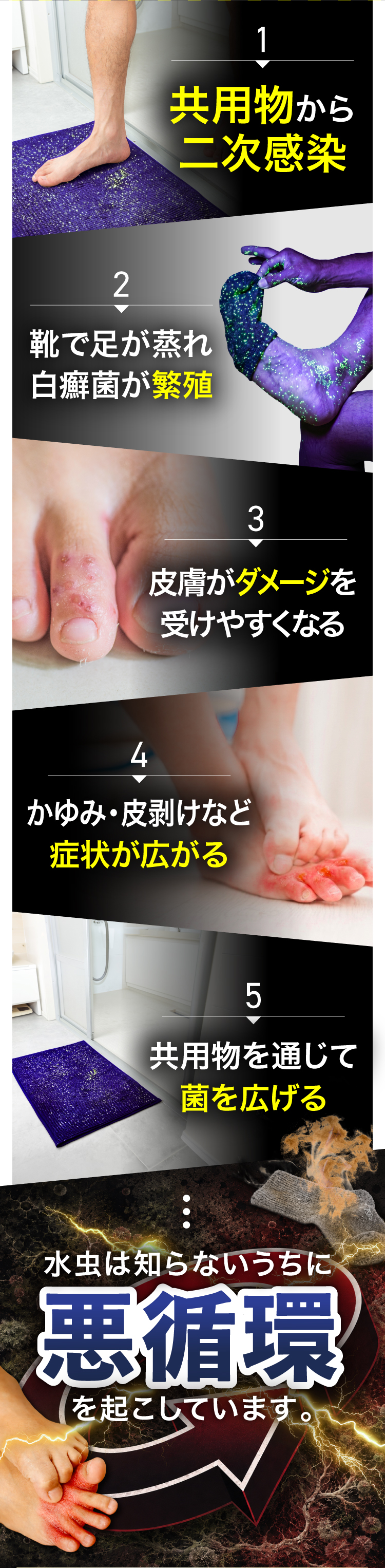 水虫が広がる5つの原因：1.共用物から二次感染 2.靴で足が蒸れ白癬菌が繁殖 3.皮膚がダメージを受けやすくなる 4.かゆみ・皮剥けなど症状が広がる 5.共用物を通じて菌を広げる。水虫は知らないうちに悪循環を起こしています。