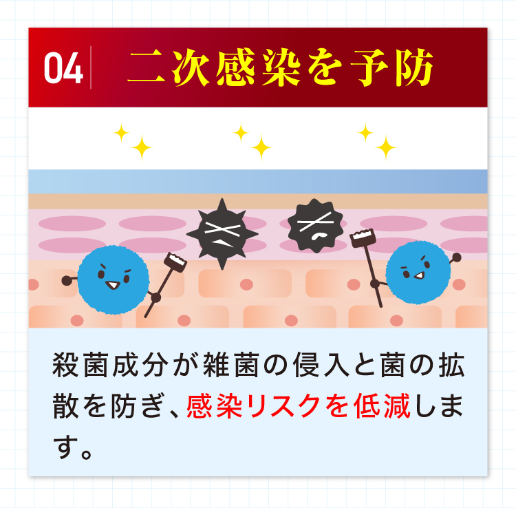 特長04 二次感染を予防：殺菌成分が雑菌の侵入と菌の拡散を防ぎ、感染リスクを低減します。