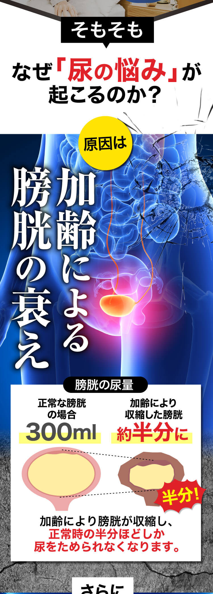 そもそも尿の悩みはなぜおこるのか?