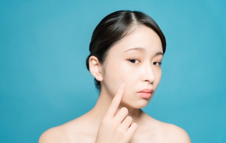 ほくろ除去おすすめクリニック10選｜皮膚科・美容外科どっちで受けるべきか解説