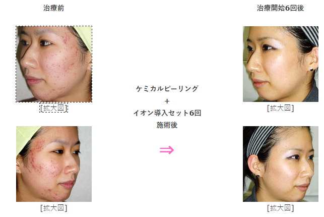 ゆかり皮膚科の症例画像