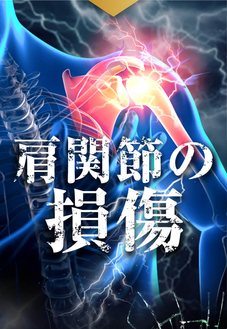 そのお悩みの原因は肩の炎症。