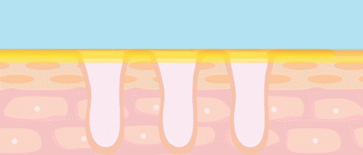 ポイント2