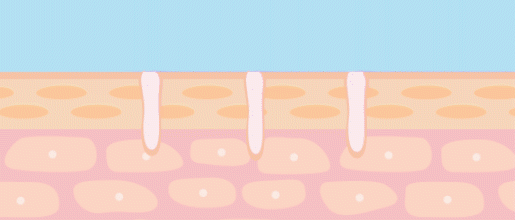 ポイント3