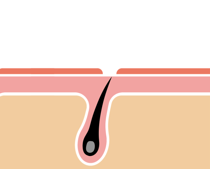 多方面からアプローチgif