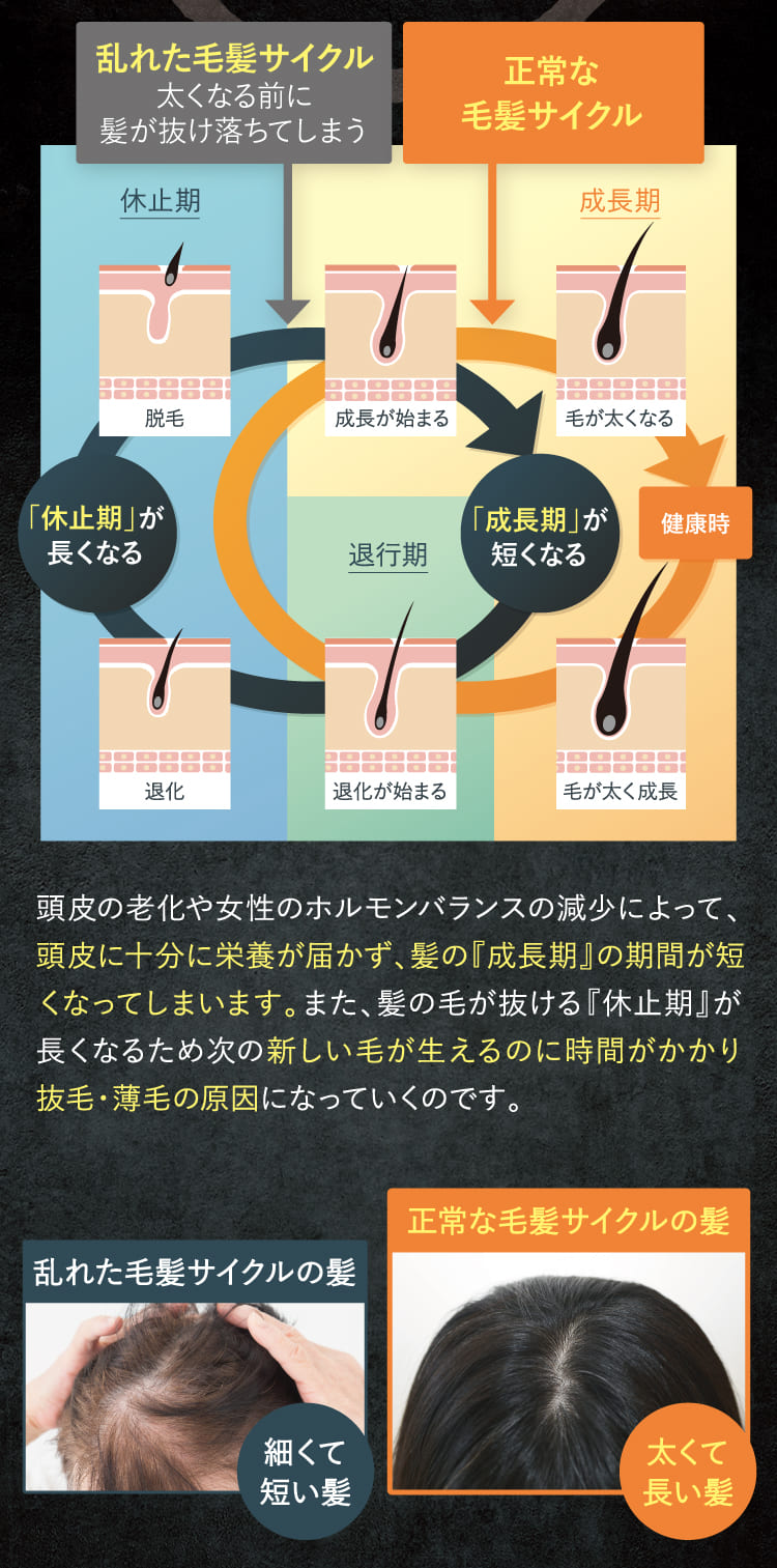 毛髪サイクルの乱れが原因！