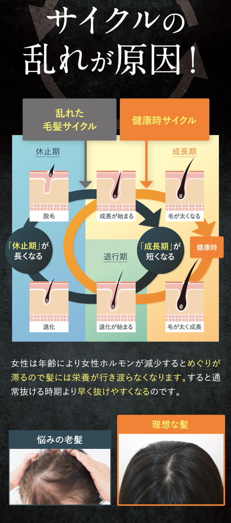 毛髪サイクルの乱れが原因！