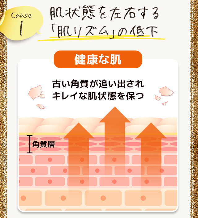 原因1 肌状態を左右する「肌リズム」の低下